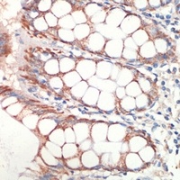 AFG3L2 Rabbit Polyclonal Antibody