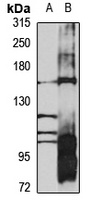 AGL Rabbit Polyclonal Antibody