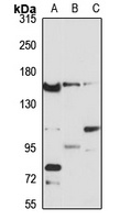 AGTPBP1 Rabbit Polyclonal Antibody