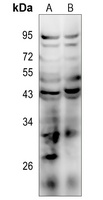 AT2 Rabbit Polyclonal Antibody