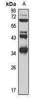 ALKBH4 Rabbit Polyclonal Antibody