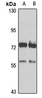 ALKBH8 Rabbit Polyclonal Antibody