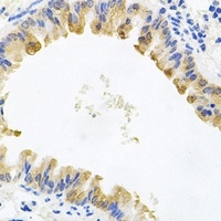ALKBH8 Rabbit Polyclonal Antibody