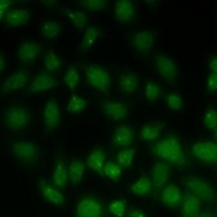 ALKBH8 Rabbit Polyclonal Antibody