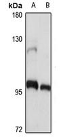 ANAPC2 Rabbit Polyclonal Antibody