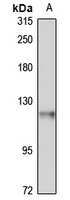 ANKLE2 Rabbit Polyclonal Antibody