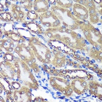 ANKLE2 Rabbit Polyclonal Antibody