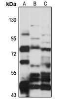 APPL2 Rabbit Polyclonal Antibody