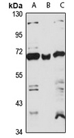 COPD Rabbit Polyclonal Antibody