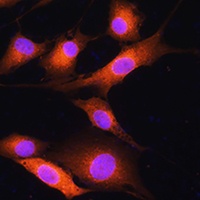 COPD Rabbit Polyclonal Antibody