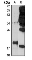 ARL1 Rabbit Polyclonal Antibody