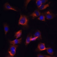 ARL13B Antibody