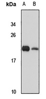 ARL4D Rabbit Polyclonal Antibody