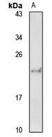 ARL6IP1 Rabbit Polyclonal Antibody
