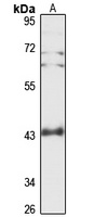 ARPC1A Rabbit Polyclonal Antibody