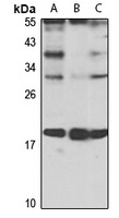 p21-ARC Rabbit Polyclonal Antibody