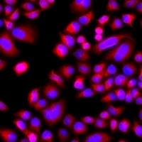 p21-ARC Rabbit Polyclonal Antibody