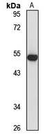 ASCC1 Rabbit Polyclonal Antibody