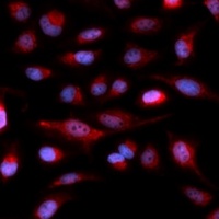 ASH2L Rabbit Polyclonal Antibody