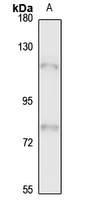ASPH Rabbit Polyclonal Antibody