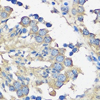 ASZ1 Rabbit Polyclonal Antibody