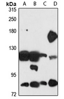 ATP13A2 Rabbit Polyclonal Antibody
