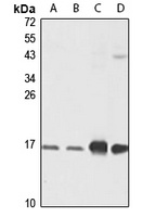 ATP5D Rabbit Polyclonal Antibody