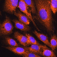 ATP5D Rabbit Polyclonal Antibody