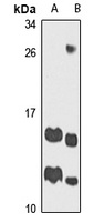 ATP5J Antibody