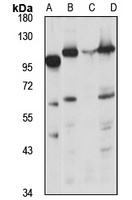 Advillin Rabbit Polyclonal Antibody