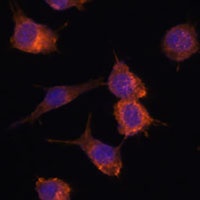 Advillin Rabbit Polyclonal Antibody