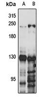 BRD4 Rabbit Polyclonal Antibody