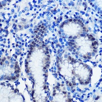 BRD4 Rabbit Polyclonal Antibody