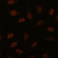 BRD4 Rabbit Polyclonal Antibody