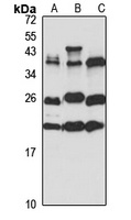 BTF3 Rabbit Polyclonal Antibody