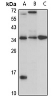 CTRP5 Rabbit Polyclonal Antibody