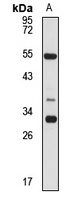 C9orf72 Rabbit Polyclonal Antibody