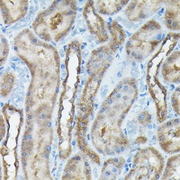 C9orf72 Rabbit Polyclonal Antibody