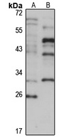 CCDC59 Rabbit Polyclonal Antibody