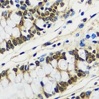 CCDC59 Rabbit Polyclonal Antibody