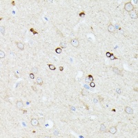 CCDC6 Antibody