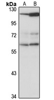 CCT6B Rabbit Polyclonal Antibody