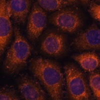 CCT6B Rabbit Polyclonal Antibody
