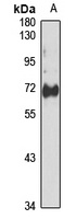 CDC7 Rabbit Polyclonal Antibody