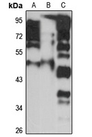 CDCA7L Rabbit Polyclonal Antibody