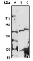CDK12 Rabbit Polyclonal Antibody