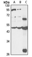CDKAL1 Antibody