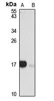 p16 INK4a Rabbit Polyclonal Antibody