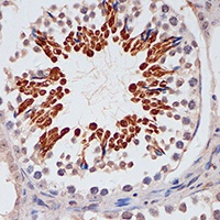 p16 INK4a Rabbit Polyclonal Antibody