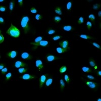 p16 INK4a Rabbit Polyclonal Antibody